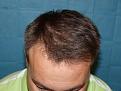 Click image for larger version

Name:	16 months post-op 02.jpg
Views:	406
Size:	53.3 KB
ID:	451248