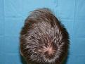 Click image for larger version

Name:	16 months post-op 12.jpg
Views:	383
Size:	60.7 KB
ID:	451258