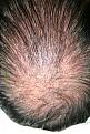 Click image for larger version

Name:	immed post op  ba 001.jpg
Views:	360
Size:	100.4 KB
ID:	451303