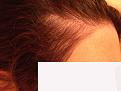 Click image for larger version

Name:	after.jpg
Views:	1663
Size:	67.3 KB
ID:	451403