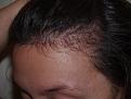 Click image for larger version

Name:	After Hairline.jpg
Views:	465
Size:	42.9 KB
ID:	451426