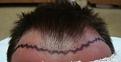 Click image for larger version

Name:	HAIRLINEDRAWN.jpg
Views:	300
Size:	94.8 KB
ID:	451470
