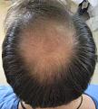 Click image for larger version

Name:	IMG_0944cropB4.jpg
Views:	439
Size:	53.7 KB
ID:	451506