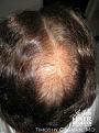 Click image for larger version

Name:	IMG_0075crop copy.jpg
Views:	406
Size:	35.4 KB
ID:	451514