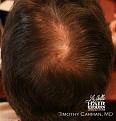 Click image for larger version

Name:	IMG_1503crop copy.jpg
Views:	437
Size:	32.5 KB
ID:	451515