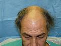 Click image for larger version

Name:	pre-op 04.jpg
Views:	585
Size:	51.7 KB
ID:	451911
