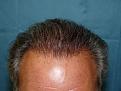 Click image for larger version

Name:	post-op 02.jpg
Views:	586
Size:	56.9 KB
ID:	451913