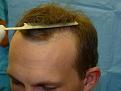 Click image for larger version

Name:	pre-op 002.jpg
Views:	560
Size:	49.0 KB
ID:	451994