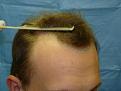 Click image for larger version

Name:	pre-op 003.jpg
Views:	570
Size:	41.6 KB
ID:	451995