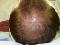 Click image for larger version

Name:	pre-op 005.jpg
Views:	573
Size:	63.2 KB
ID:	451997
