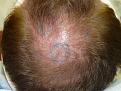 Click image for larger version

Name:	pre-op 006.jpg
Views:	585
Size:	80.6 KB
ID:	451998