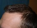 Click image for larger version

Name:	post-op 005.jpg
Views:	570
Size:	55.4 KB
ID:	452003