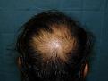 Click image for larger version

Name:	Pre-op 05.jpg
Views:	447
Size:	49.3 KB
ID:	452257