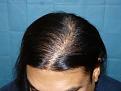 Click image for larger version

Name:	8 months post-op 06.jpg
Views:	466
Size:	54.0 KB
ID:	452269