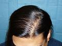 Click image for larger version

Name:	8 months post-op 07.jpg
Views:	444
Size:	59.2 KB
ID:	452270
