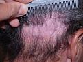 Click image for larger version

Name:	Before Scar Repair.jpg
Views:	904
Size:	96.5 KB
ID:	452448