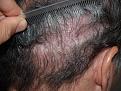 Click image for larger version

Name:	After Scar Repair.jpg
Views:	1525
Size:	94.5 KB
ID:	452449