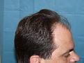 Click image for larger version

Name:	pre-op 04.jpg
Views:	445
Size:	55.7 KB
ID:	452519