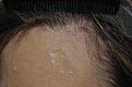 Click image for larger version

Name:	good trichobrow 2r.jpg
Views:	1009
Size:	45.1 KB
ID:	452548