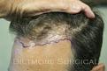Click image for larger version

Name:	DR preop a.jpg
Views:	525
Size:	19.7 KB
ID:	452567