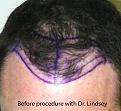 Click image for larger version

Name:	2r.jpg
Views:	450
Size:	70.5 KB
ID:	452646