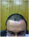 Click image for larger version

Name:	February 1 2011.jpg
Views:	495
Size:	12.1 KB
ID:	452744