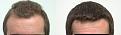 Click image for larger version

Name:	Front before and after.jpg
Views:	687
Size:	99.4 KB
ID:	452751