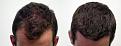 Click image for larger version

Name:	Top before and after.jpg
Views:	850
Size:	96.0 KB
ID:	452753
