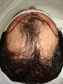 Click image for larger version

Name:	HAIRLINEDRAWNBACK.jpg
Views:	356
Size:	93.1 KB
ID:	452819