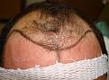 Click image for larger version

Name:	HAIRLINEDRAWNFRONT.jpg
Views:	341
Size:	93.3 KB
ID:	452820