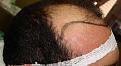 Click image for larger version

Name:	HAIRLINEDRAWNRIGHT.jpg
Views:	314
Size:	98.1 KB
ID:	452822