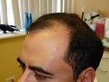 Click image for larger version

Name:	pre-op 003.jpg
Views:	410
Size:	54.0 KB
ID:	452837