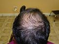 Click image for larger version

Name:	pre-op 004.jpg
Views:	411
Size:	65.0 KB
ID:	452838