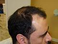 Click image for larger version

Name:	pre-op 005.jpg
Views:	427
Size:	50.3 KB
ID:	452839