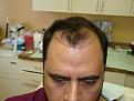 Click image for larger version

Name:	pre-op 006.jpg
Views:	415
Size:	46.0 KB
ID:	452840