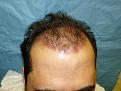 Click image for larger version

Name:	1 day post-op 001.jpg
Views:	425
Size:	55.0 KB
ID:	452841