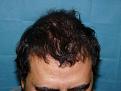 Click image for larger version

Name:	8 months post-op 02.jpg
Views:	421
Size:	51.9 KB
ID:	452846