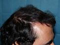 Click image for larger version

Name:	8 months post-op 04.jpg
Views:	433
Size:	64.6 KB
ID:	452848