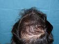 Click image for larger version

Name:	8 months post-op 08.jpg
Views:	402
Size:	67.5 KB
ID:	452852