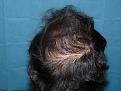 Click image for larger version

Name:	8 months post-op 09.jpg
Views:	403
Size:	60.9 KB
ID:	452853