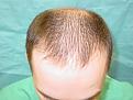 Click image for larger version

Name:	pre-op 03.jpg
Views:	319
Size:	58.7 KB
ID:	452857