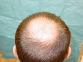 Click image for larger version

Name:	pre-op 04.jpg
Views:	301
Size:	54.1 KB
ID:	452858