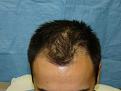 Click image for larger version

Name:	pre-op 02.jpg
Views:	421
Size:	44.3 KB
ID:	452872