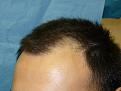 Click image for larger version

Name:	pre-op 03.jpg
Views:	415
Size:	45.5 KB
ID:	452873