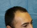 Click image for larger version

Name:	pre-op 04.jpg
Views:	424
Size:	46.2 KB
ID:	452874