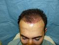 Click image for larger version

Name:	post-op 01.jpg
Views:	422
Size:	53.6 KB
ID:	452876