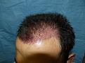 Click image for larger version

Name:	post-op 02.jpg
Views:	431
Size:	55.4 KB
ID:	452877