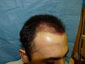 Click image for larger version

Name:	post-op 03.jpg
Views:	414
Size:	51.5 KB
ID:	452878