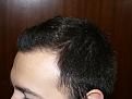 Click image for larger version

Name:	8 months post-op 04.jpg
Views:	430
Size:	55.4 KB
ID:	452882