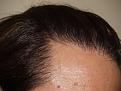Click image for larger version

Name:	16 Months Close-Up.jpg
Views:	380
Size:	95.7 KB
ID:	452937